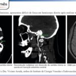 cirurgiao-vascular-dr-daniel-benitti-Folha-Vascular-164 cirurgiao-vascular-dr-daniel-benitti-Folha-Vascular-164