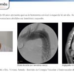 cirurgiao-vascular-dr-daniel-benitti-Folha-vascular-166 cirurgiao-vascular-dr-daniel-benitti-Folha-vascular-166