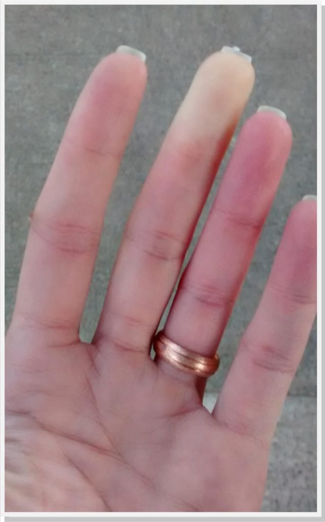 fenomeno-de-raynaud-dr-daniel-benitti-cirurgiao-vascular fenomeno-de-raynaud-dr-daniel-benitti-cirurgiao-vascular