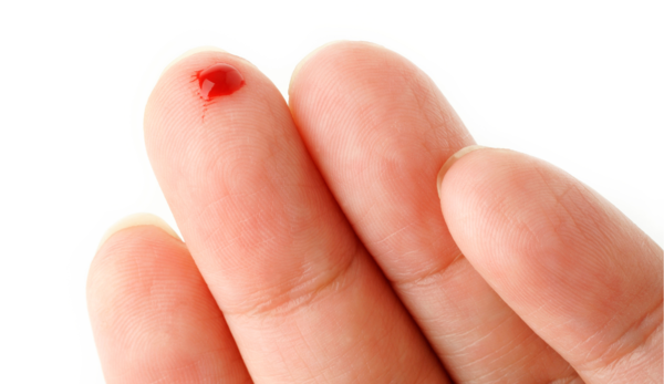 cicatrizacaoruim-ma-alimentacao-dr-dr-daniel-benitti-medico-cirurgiao-vascular