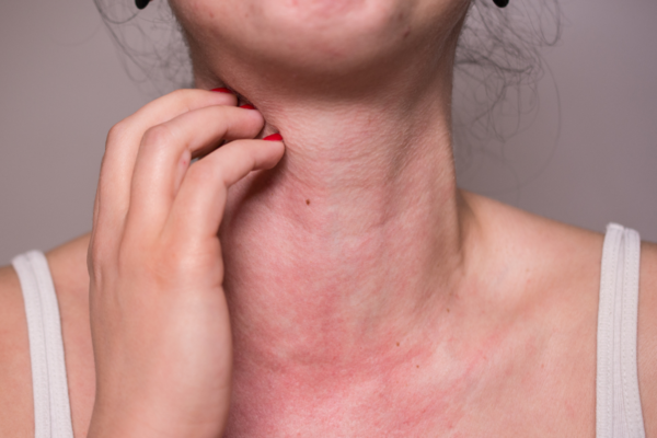 alergia-alimentar-dr-daniel-benitti-cirurgiao-vascular alergia-alimentar-dr-daniel-benitti-cirurgiao-vascular